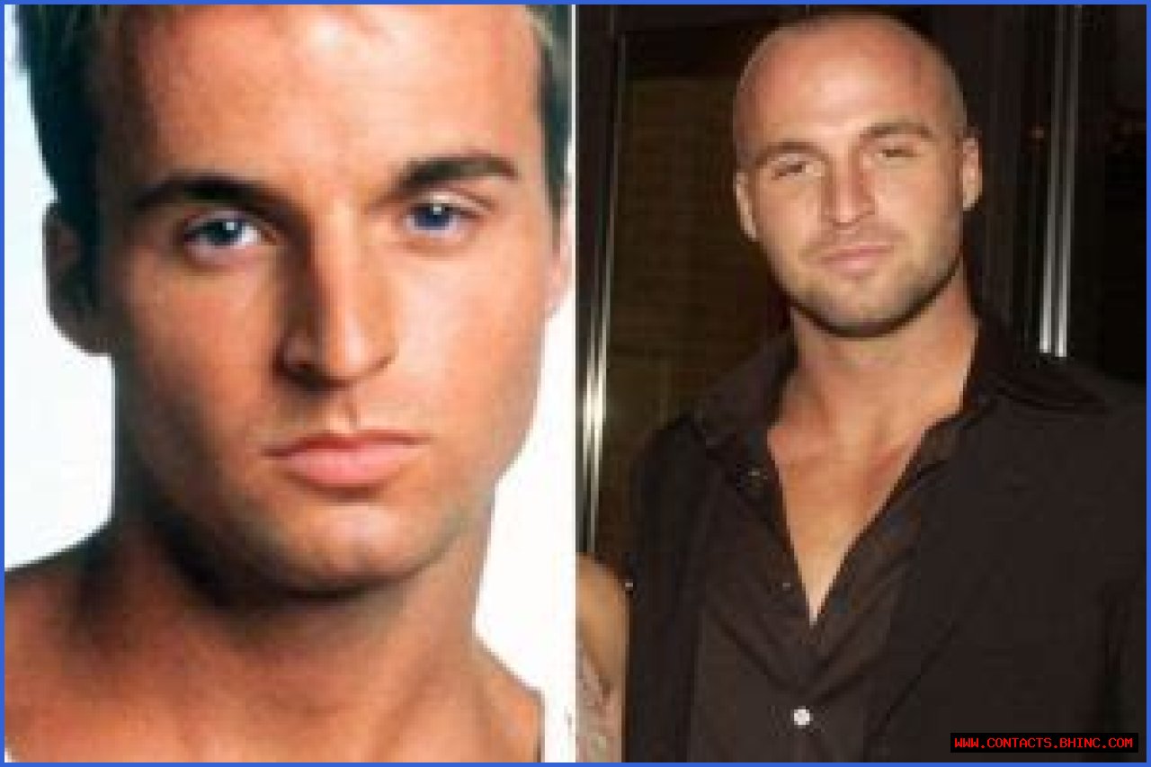 Actor Ben Unwin’s Wiki, Cause of Death, Net Worth, Girlfriend, Height, Married, and Wife!!