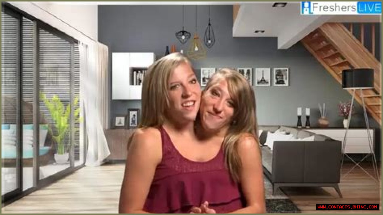 Are Abby and Brittany Hensel Still Alive? What Happened to Them?