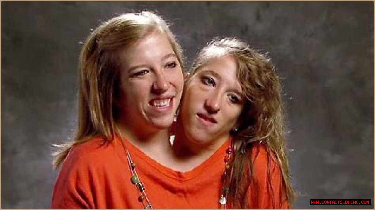 Brittany and Abby Married: The Truth About the Conjoined Twins’ Love Life