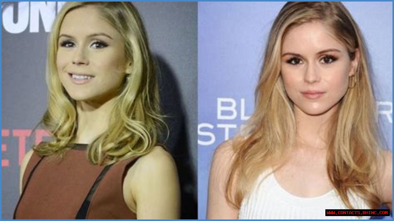 The Boys’ Starlight Actress Looks Different in Before and After Pictures!