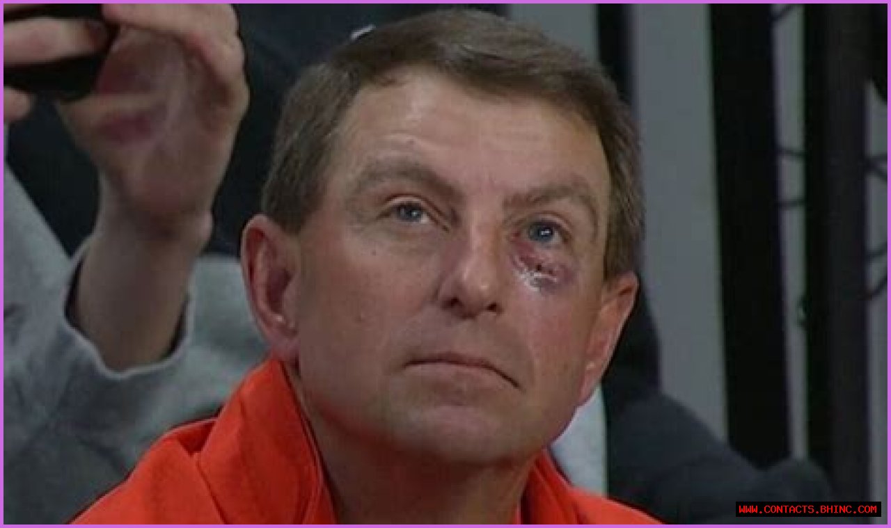 What Happened to Dabo Swinney's Eye? How Did Dabo Swinney Get a Black Eye?